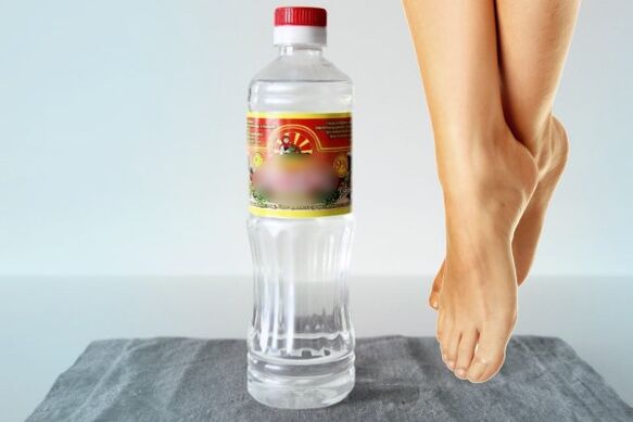 Vinegar lotions are used to treat a fungal infection between the toes. 