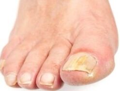 After the bathroom, the nail interested is easier to remove