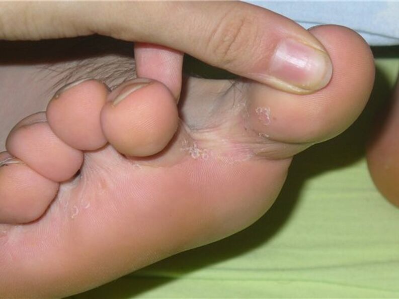The mushroom between the fingers