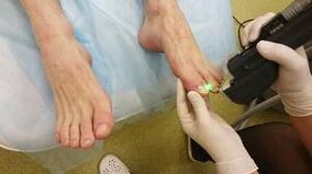 Mushroom hardware treatment