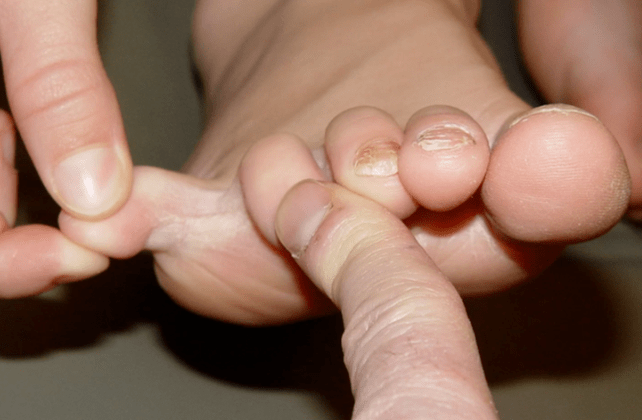 Mushroom between the fingers