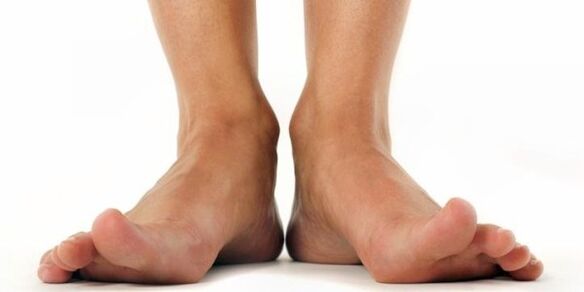 fungus on the feet