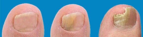 Mushroom development process