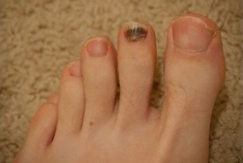 Use of oral and topical medications