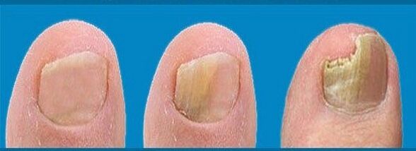 mushroom development process